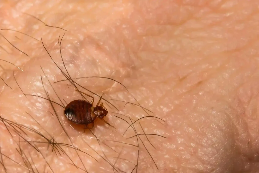 Bettwanzenbefall frühzeitig erkennen und Hautausschläge vermeiden – Kammerjäger Bad Kreuznach